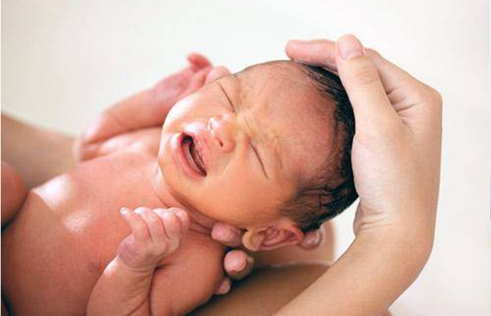 Reanimacion Neonatal / Atención al nacimiento del recien nacido